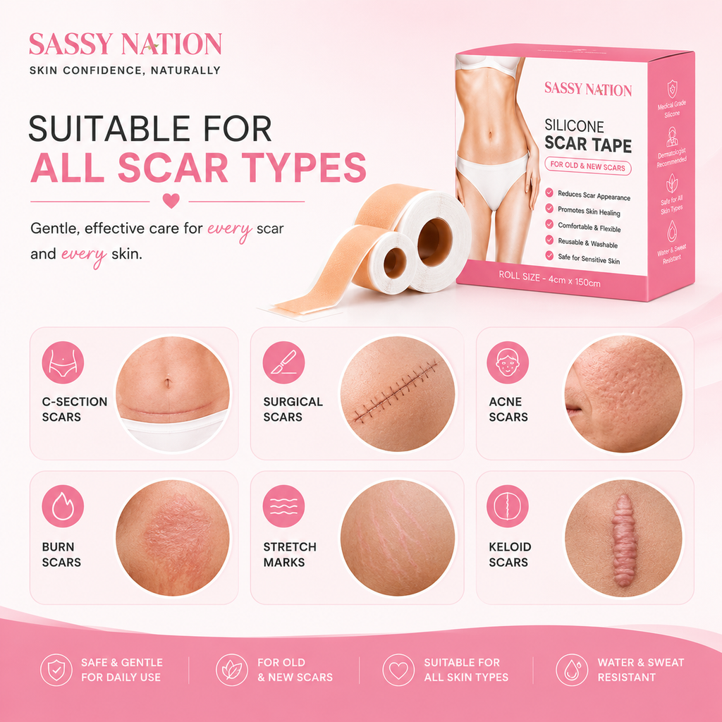 Sassy Nation ScarShield™